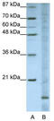 Apolipoprotein O antibody, TA343927, Origene, Western Blot image 