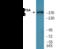 DNA Topoisomerase II Alpha antibody, EKC2591, Boster Biological Technology, Western Blot image 