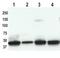Keratin 19 antibody, ab7754, Abcam, Western Blot image 