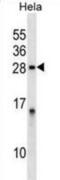 Protein Phosphatase 1 Regulatory Inhibitor Subunit 2 antibody, abx028566, Abbexa, Western Blot image 