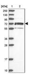 AceCS2 antibody, NBP2-30612, Novus Biologicals, Western Blot image 
