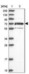 Acyl-CoA Synthetase Short Chain Family Member 1 antibody, NBP2-30612, Novus Biologicals, Western Blot image 