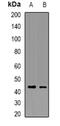 Transcription Factor AP-2 Beta antibody, abx142029, Abbexa, Western Blot image 