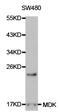 Midkine antibody, TA326798, Origene, Western Blot image 