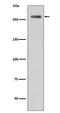 Leucine Rich Repeat Kinase 2 antibody, P00221, Boster Biological Technology, Western Blot image 