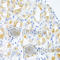 Choriogonadotropin subunit beta antibody, A1817, ABclonal Technology, Immunohistochemistry paraffin image 