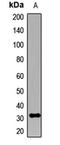 Kv channel-interacting protein 2 antibody, LS-C668746, Lifespan Biosciences, Western Blot image 