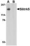 SLIT And NTRK Like Family Member 5 antibody, TA306529, Origene, Western Blot image 