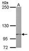 Tubulin Tyrosine Ligase Like 7 antibody, GTX121125, GeneTex, Western Blot image 