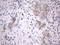 Integrin Subunit Beta 1 Binding Protein 1 antibody, LS-C789993, Lifespan Biosciences, Immunohistochemistry paraffin image 