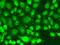 TRNA Splicing Endonuclease Subunit 2 antibody, PA5-76281, Invitrogen Antibodies, Immunofluorescence image 