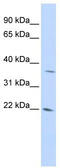 DNA Damage Inducible Transcript 4 Like antibody, TA340396, Origene, Western Blot image 