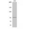 Proteasome 26S Subunit, Non-ATPase 2 antibody, LS-C385659, Lifespan Biosciences, Western Blot image 