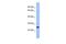 DR1 Associated Protein 1 antibody, GTX48940, GeneTex, Western Blot image 