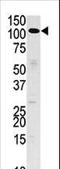 Hexokinase 3 antibody, LS-C101270, Lifespan Biosciences, Western Blot image 