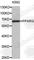 Peroxisome Proliferator Activated Receptor Gamma antibody, A5607, ABclonal Technology, Western Blot image 