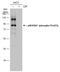 Ribosomal Protein S6 Kinase A1 antibody, GTX133612, GeneTex, Western Blot image 