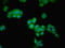 Glucosamine-6-Phosphate Deaminase 2 antibody, orb47719, Biorbyt, Immunocytochemistry image 