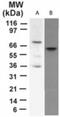 Tumor Protein P73 antibody, GTX46123, GeneTex, Western Blot image 