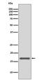 Anterior Gradient 2, Protein Disulphide Isomerase Family Member antibody, M02922, Boster Biological Technology, Western Blot image 