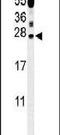 Inosine Triphosphatase antibody, PA5-24867, Invitrogen Antibodies, Western Blot image 