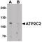 Calcium-transporting ATPase type 2C member 2 antibody, PA5-21127, Invitrogen Antibodies, Western Blot image 