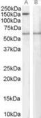 Signal-Induced Proliferation-Associated 1 antibody, NB100-1390, Novus Biologicals, Western Blot image 