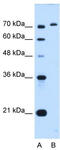 Glycosylphosphatidylinositol Anchor Attachment 1 antibody, TA339374, Origene, Western Blot image 