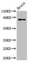 GIT ArfGAP 1 antibody, orb52595, Biorbyt, Western Blot image 