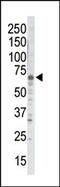 G Protein-Coupled Receptor Kinase 5 antibody, 62-585, ProSci, Western Blot image 