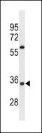 Olfactory Receptor Family 52 Subfamily A Member 5 antibody, LS-C158016, Lifespan Biosciences, Western Blot image 