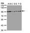 Carcinoembryonic Antigen Related Cell Adhesion Molecule 5 antibody, TA308866, Origene, Western Blot image 