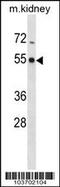 Phosphorylase Kinase Catalytic Subunit Gamma 2 antibody, 62-746, ProSci, Western Blot image 