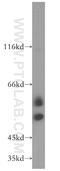 T-Complex 11 antibody, 14606-1-AP, Proteintech Group, Western Blot image 