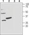 Potassium Calcium-Activated Channel Subfamily M Regulatory Beta Subunit 3 antibody, PA5-77615, Invitrogen Antibodies, Western Blot image 