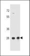Coiled-Coil Domain Containing 134 antibody, LS-C168399, Lifespan Biosciences, Western Blot image 