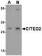 Cbp/P300 Interacting Transactivator With Glu/Asp Rich Carboxy-Terminal Domain 2 antibody, A02966, Boster Biological Technology, Western Blot image 