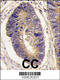 Protein Tyrosine Phosphatase Non-Receptor Type 3 antibody, 63-464, ProSci, Immunohistochemistry paraffin image 