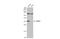 Secreted Frizzled Related Protein 2 antibody, GTX111892, GeneTex, Western Blot image 