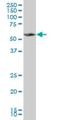 Membrane Palmitoylated Protein 1 antibody, H00004354-M03, Novus Biologicals, Western Blot image 