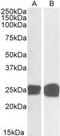Growth Factor Receptor Bound Protein 2 antibody, MBS421084, MyBioSource, Western Blot image 