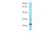 Serine Protease 58 antibody, A16089, Boster Biological Technology, Western Blot image 