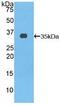 ATP Binding Cassette Subfamily A Member 3 antibody, abx128628, Abbexa, Western Blot image 