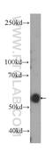 Ectonucleoside Triphosphate Diphosphohydrolase 1 antibody, 60323-1-Ig, Proteintech Group, Western Blot image 