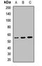 CD5 Molecule antibody, LS-C668039, Lifespan Biosciences, Western Blot image 