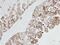 Keratin 19 antibody, PA5-29548, Invitrogen Antibodies, Immunohistochemistry paraffin image 