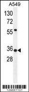 Sosondowah Ankyrin Repeat Domain Family Member D antibody, 56-071, ProSci, Western Blot image 