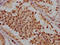 ATM Serine/Threonine Kinase antibody, CSB-RA166706A0HU, Cusabio, Immunohistochemistry frozen image 