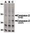 Caspase 2 antibody, PA5-20107, Invitrogen Antibodies, Western Blot image 