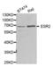 Estrogen Receptor 2 antibody, abx001984, Abbexa, Western Blot image 